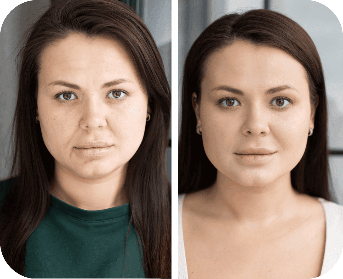 Brianna before / after